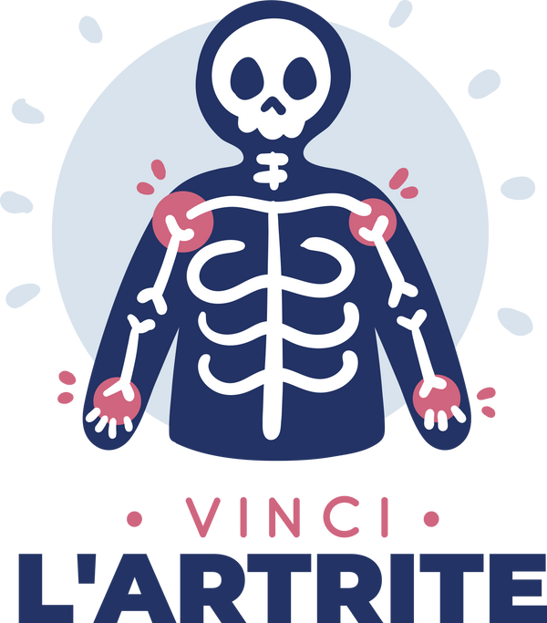 Vinci l'artrite